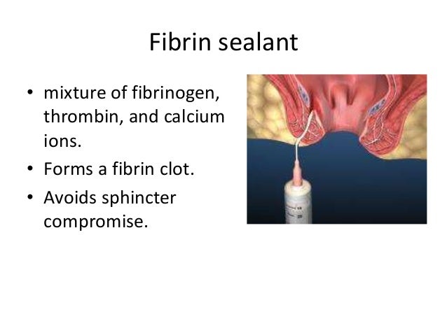 fibrin glue and anal fistulas Schnieder mature ugly blog